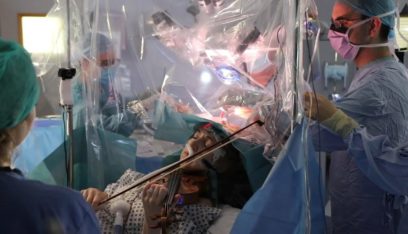 بالفيديو: مريضة تعزف الكمان أثناء الخضوع لجراحة استئصال ورم!