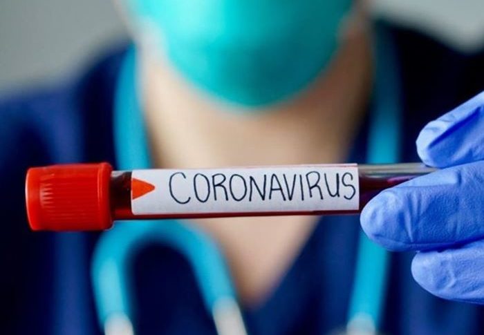 الصحة الإسرائيلية: تسجيل 663 إصابة جديدة بفيروس كورونا