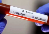 نتيجة الـ PCR لموظفة المالية جنوباً سلبية