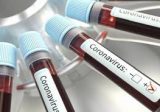 7 إصابات جديدة بفيروس كورونا في زغرتا