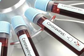 7 إصابات جديدة بفيروس كورونا في زغرتا