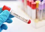 بلدية مجدليون : تسجيل ثلاث اصابات اضافية بفيروس كورونا