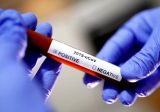 18 إصابة جديدة بفيروس كورونا في قضاء زغرتا