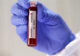 6 إصابات جديدة بفيروس كورونا في المنية خلال 72 ساعة