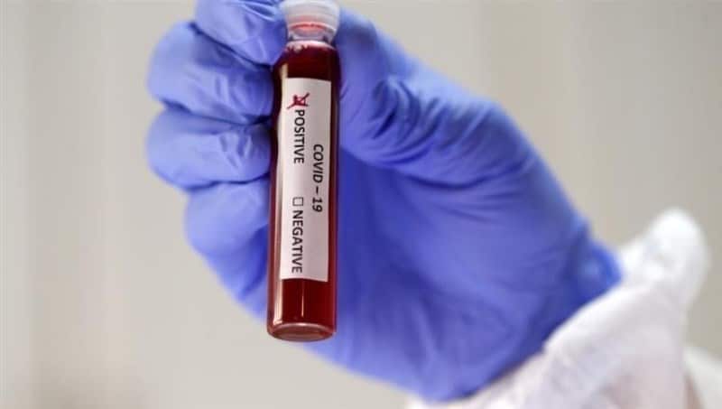 الصحة الإسبانية: تسجيل 40197 إصابة جديدة بفيروس كورونا