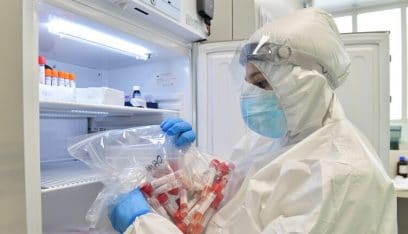 معامل ألمانيا تعيد اختبار آلاف العينات من كورونا