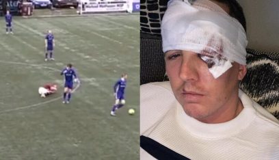 بالفيديو: لاعب ينطح منافسه بوحشية.. “كادت تفقده عينه إلى الأبد”