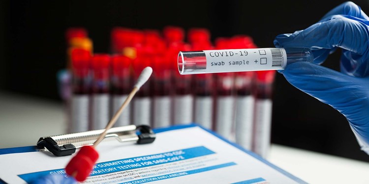 وول ستريت جورنال: تقرير أميركي رسمي يخلص إلى أن فيروس كورونا تسرب من مختبر
