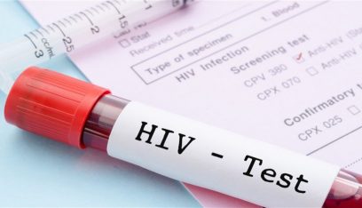 الأمم المتحدة تحدد موعد القضاء على “الإيدز” في العالم!