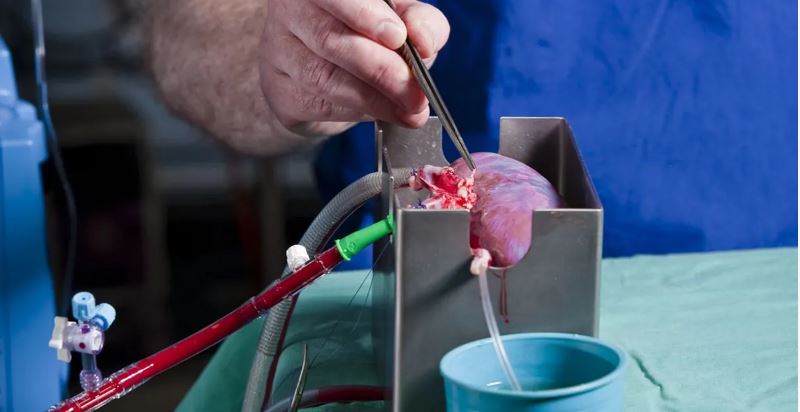 سابقة علمية.. تغيير فصيلة الدم لزراعة الأعضاء بات ممكناً!