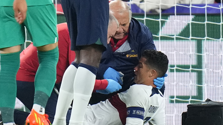 رونالدو يتعرض لإصابة خلال مباراة البرتغال والتشيك
