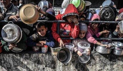 50 طفلاً يعانون من سوء التغذية والمجاعة شمال قطاع غزة