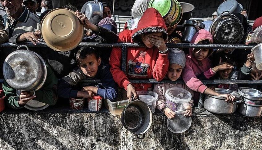 50 طفلاً يعانون من سوء التغذية والمجاعة شمال قطاع غزة