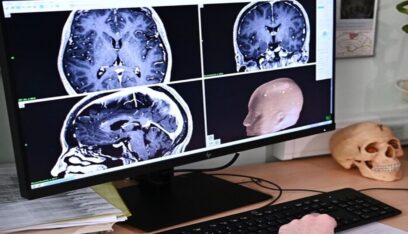 الصحة الاسرائيلية: تسجيل إصابة بالتهاب دماغي ناتج عن “أميبا” نادرة