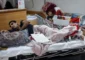 الصحّة في غزة: نحو 1500 مواطن فلسطيني فقدوا البصر جرّاء حرب الإبادة